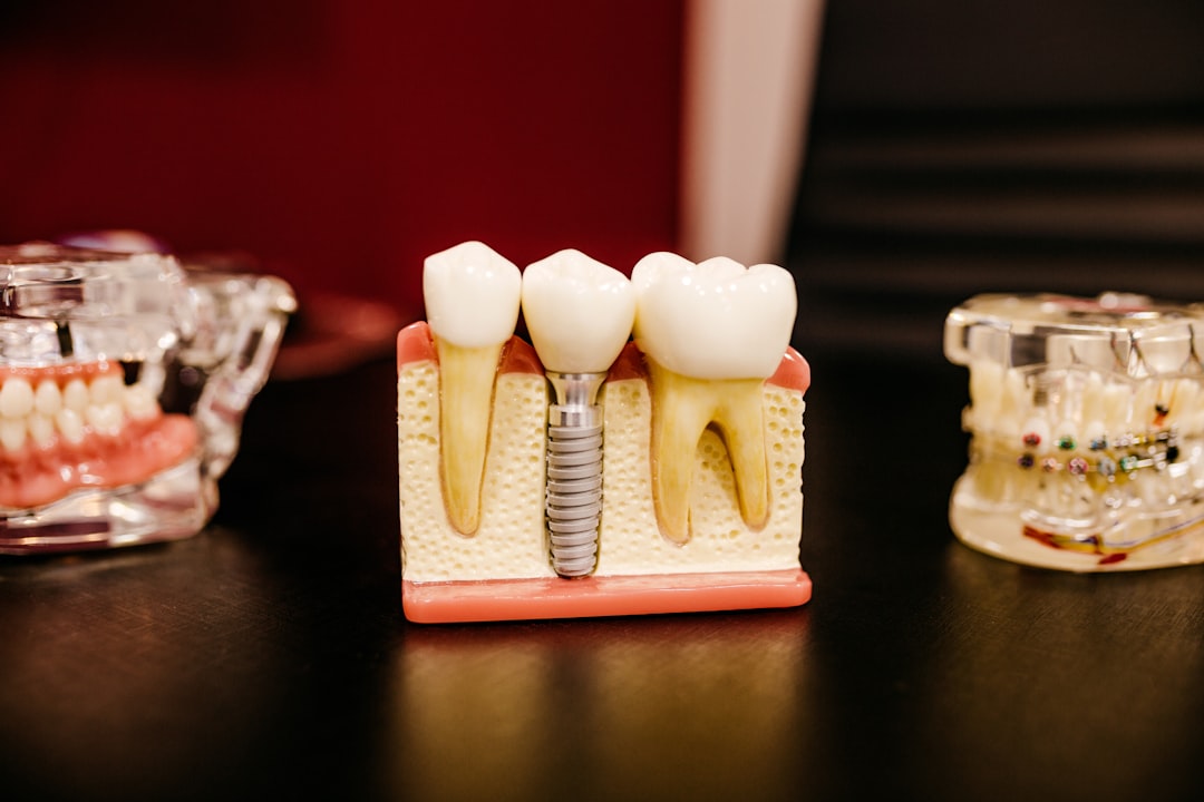 Photo Dental implants